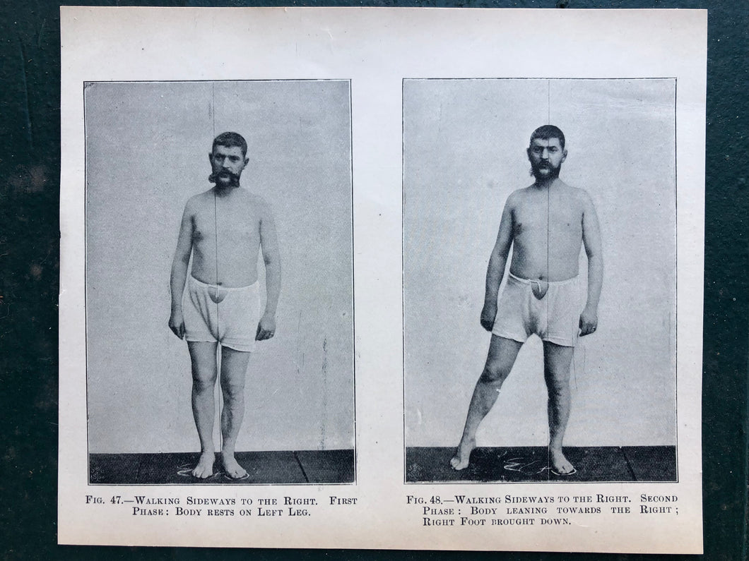 Figs. 47 and 48. Print from “The Treatment of Tabetic Ataxia by Means of Systematic Exercise” by Dr. H. S. Frenkel
