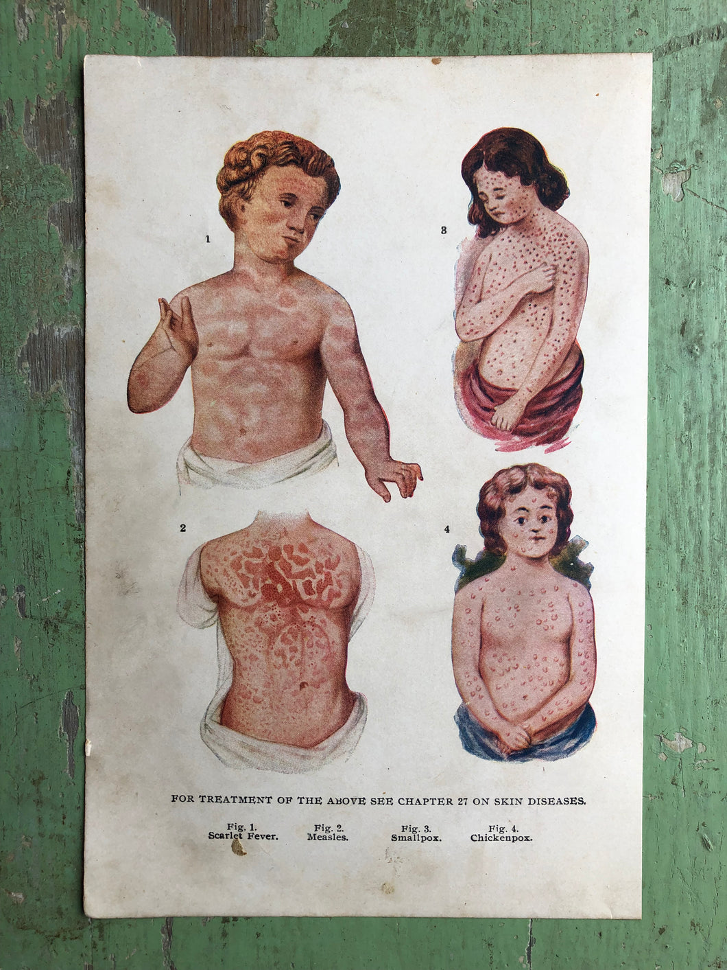 Skin Diseases. Print from 