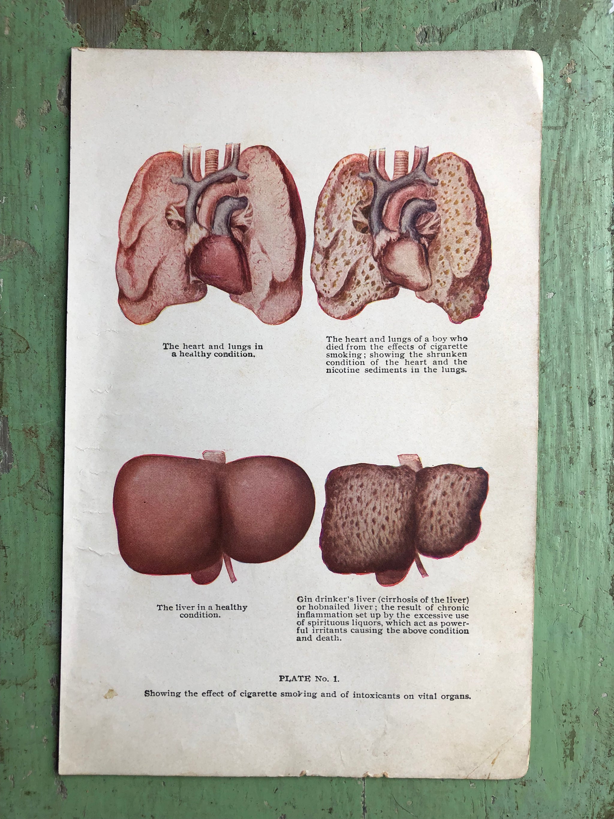 cigarette effects on liver Effects of cigarettes and alcohol on the liver and lungs. Print from 