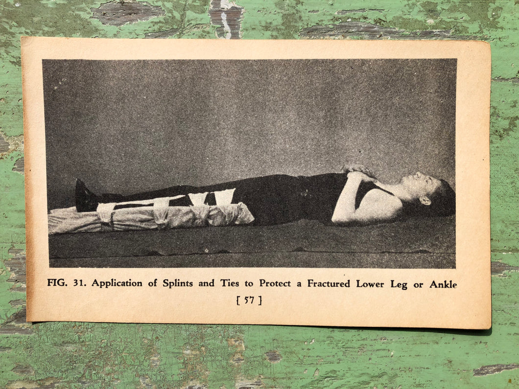 Fig. 31, Print from A Handy Guide to First Aid. by James Carlton Zwetsch