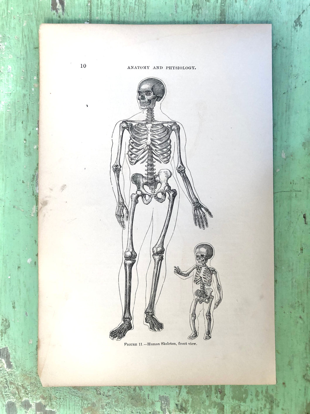 Print from “Wood’s Household Practice of Medicine, Hygeine and Surgery, Vol. I”