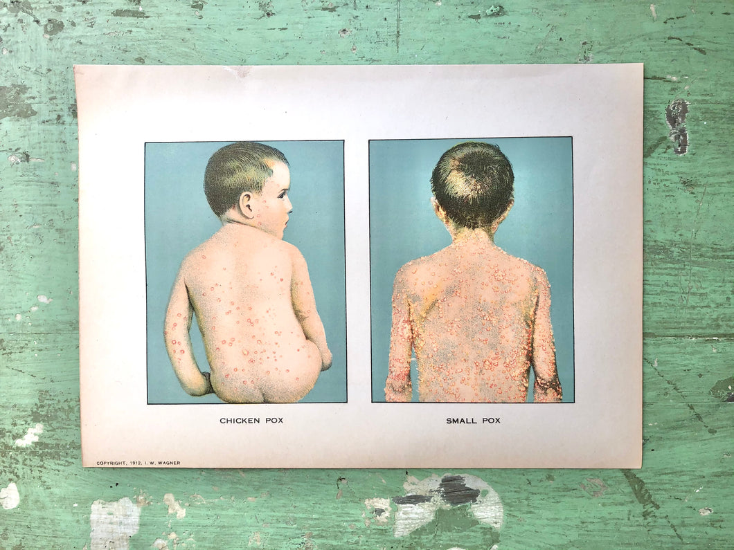 Print from “Domestic Medical Practice: A Household Adviser in the Treatment of Diseases, Arranged for Family Use”