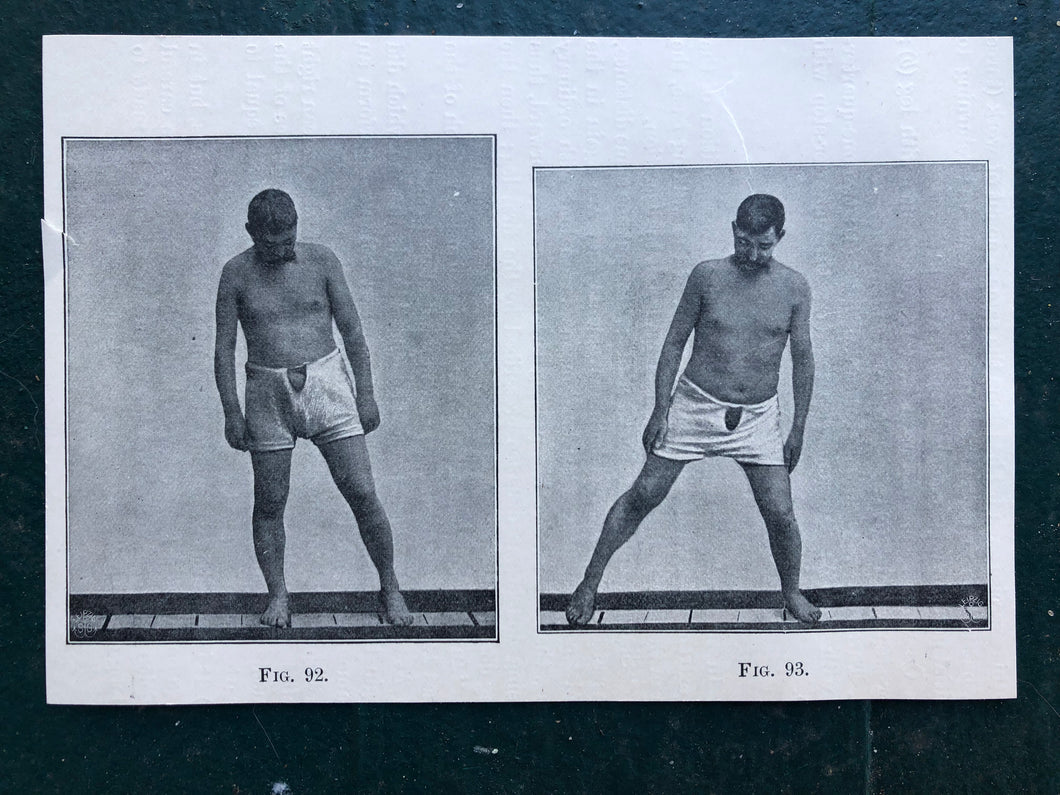 Figs. 92 and 93. Print from “The Treatment of Tabetic Ataxia by Means of Systematic Exercise” by Dr. H. S. Frenkel