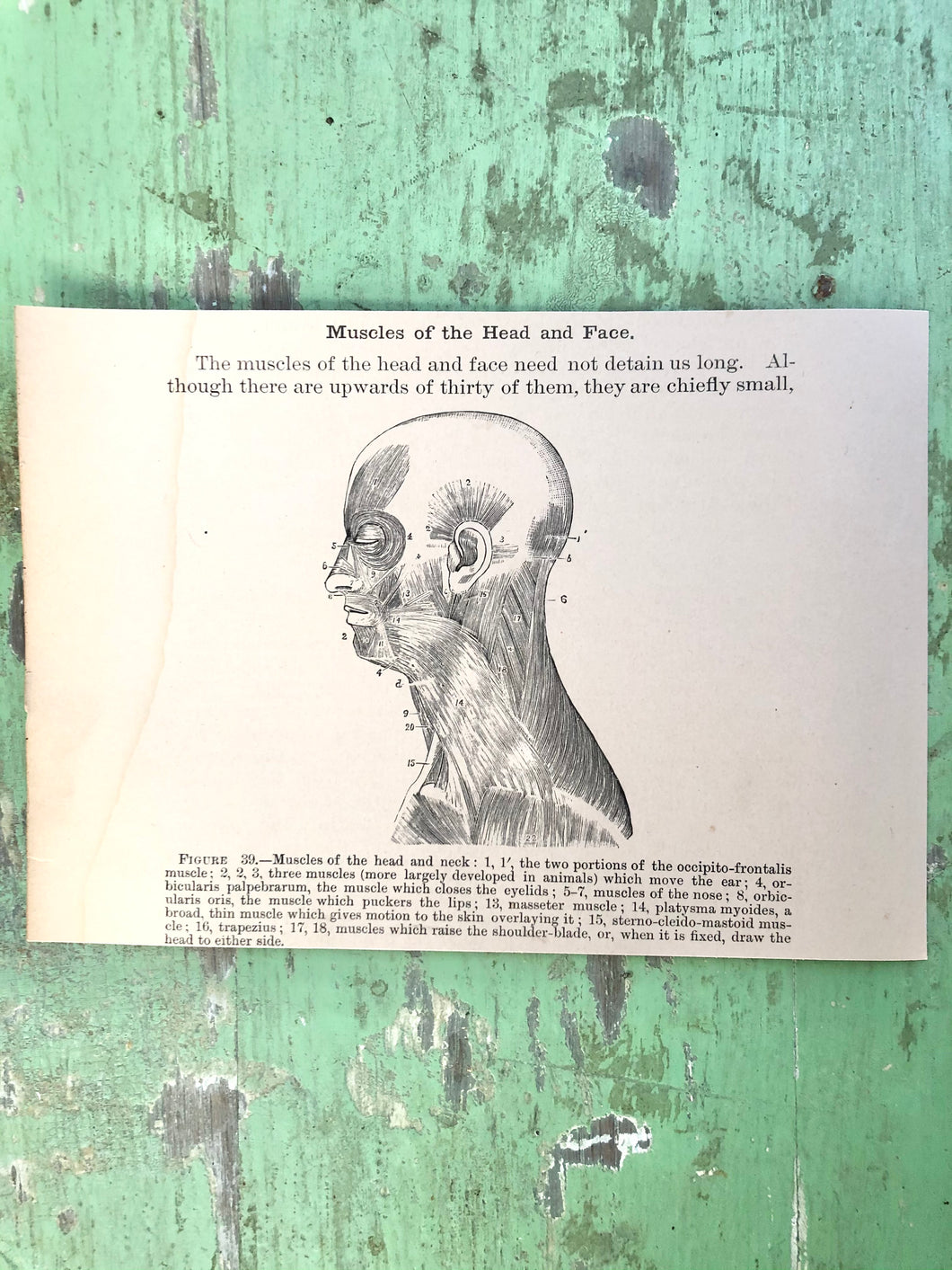 Print from “Wood’s Household Practice of Medicine, Hygeine and Surgery, Vol. I”
