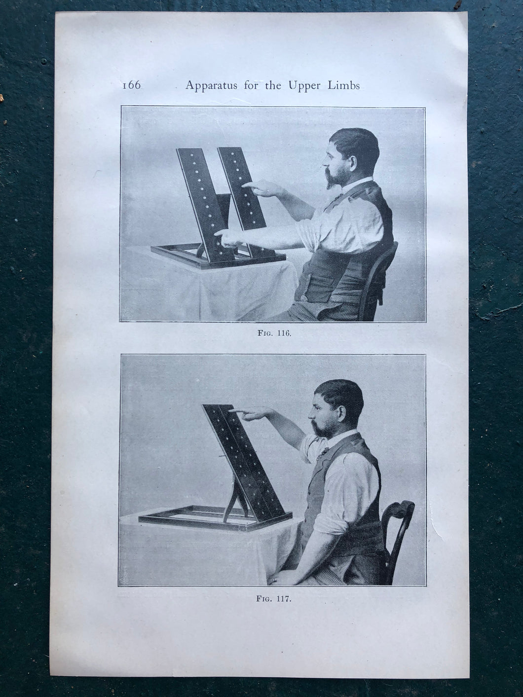 Figs. 116 and 117. Print from “The Treatment of Tabetic Ataxia by Means of Systematic Exercise” by Dr. H. S. Frenkel