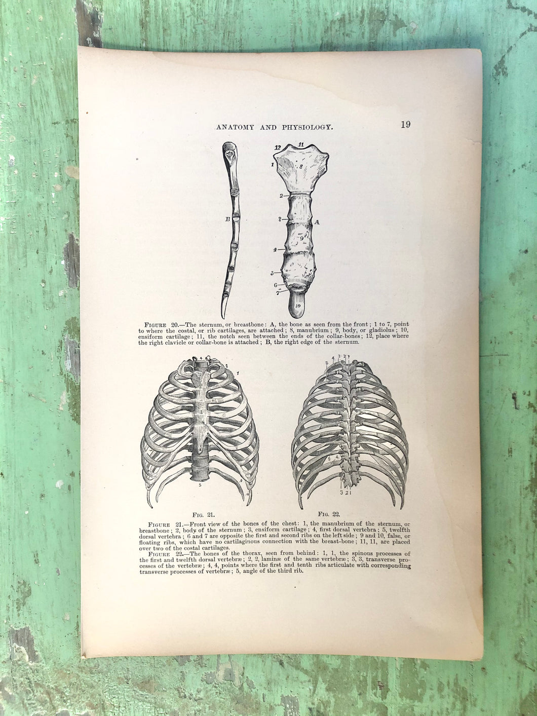 Print from “Wood’s Household Practice of Medicine, Hygeine and Surgery, Vol. I”