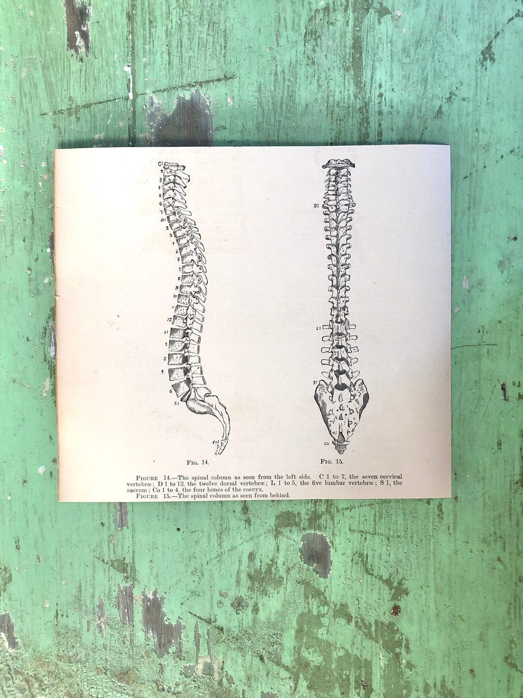 Print from “Wood’s Household Practice of Medicine, Hygeine and Surgery, Vol. I”