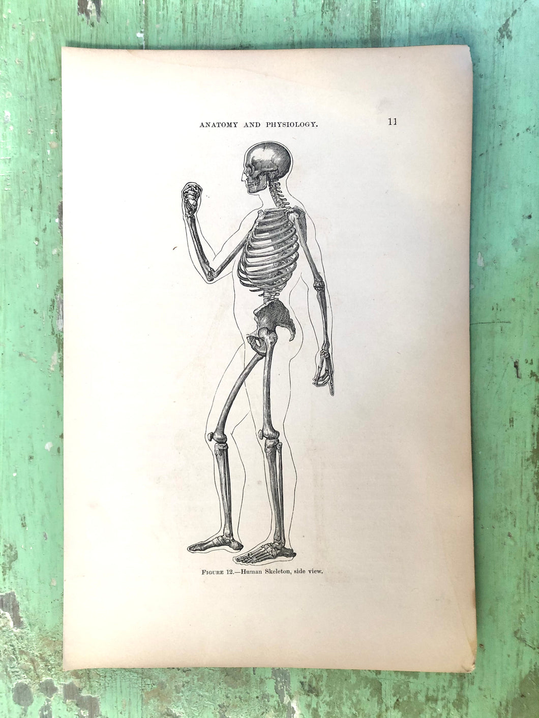 Print from “Wood’s Household Practice of Medicine, Hygeine and Surgery, Vol. I”