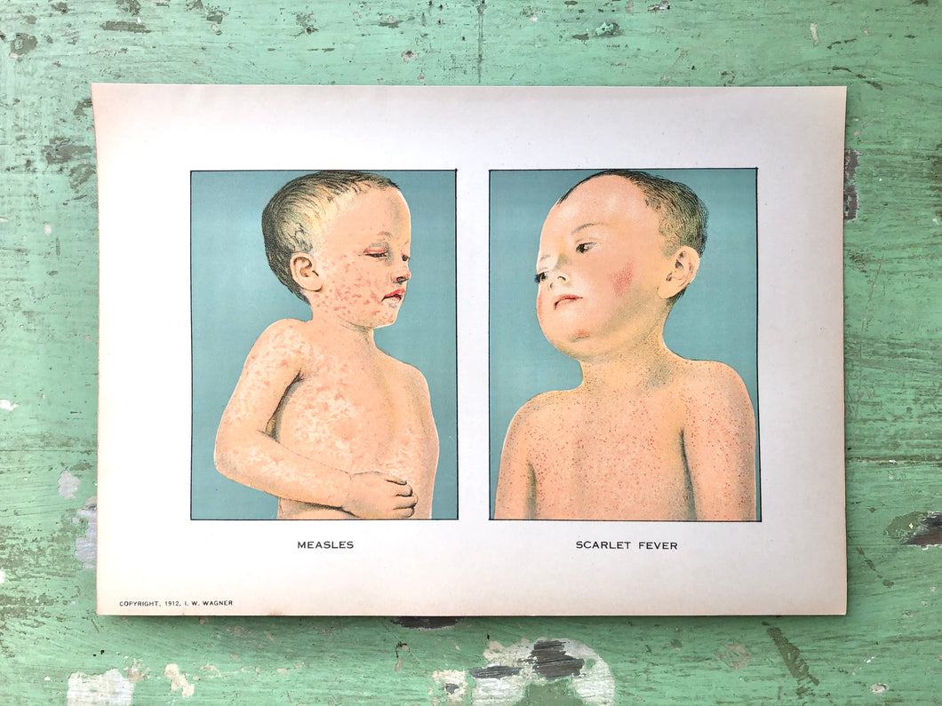 Print from “Domestic Medical Practice: A Household Adviser in the Treatment of Diseases, Arranged for Family Use”