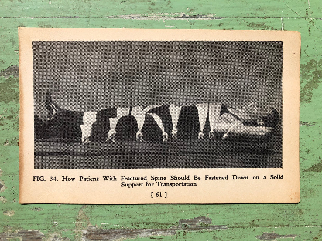 Fig. 34, Print from A Handy Guide to First Aid. by James Carlton Zwetsch