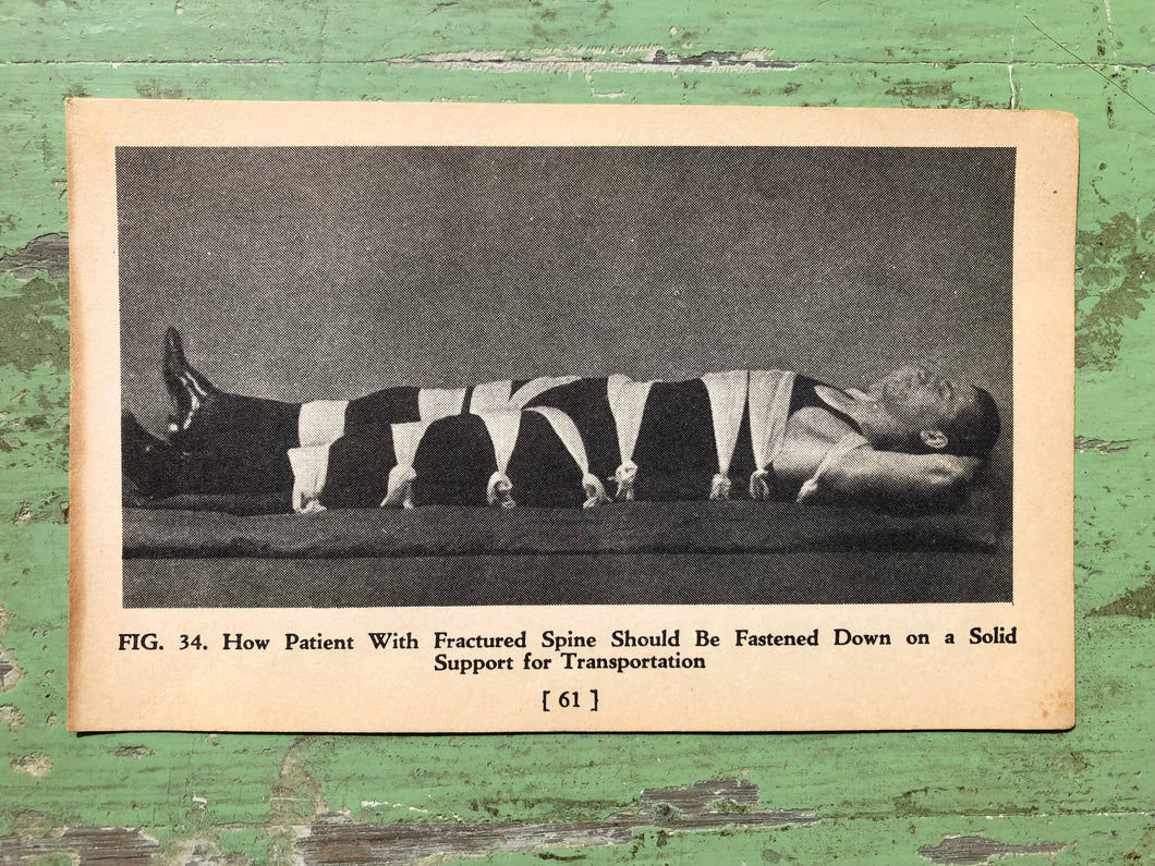 Fig. 34, Print from A Handy Guide to First Aid. by James Carlton Zwetsch