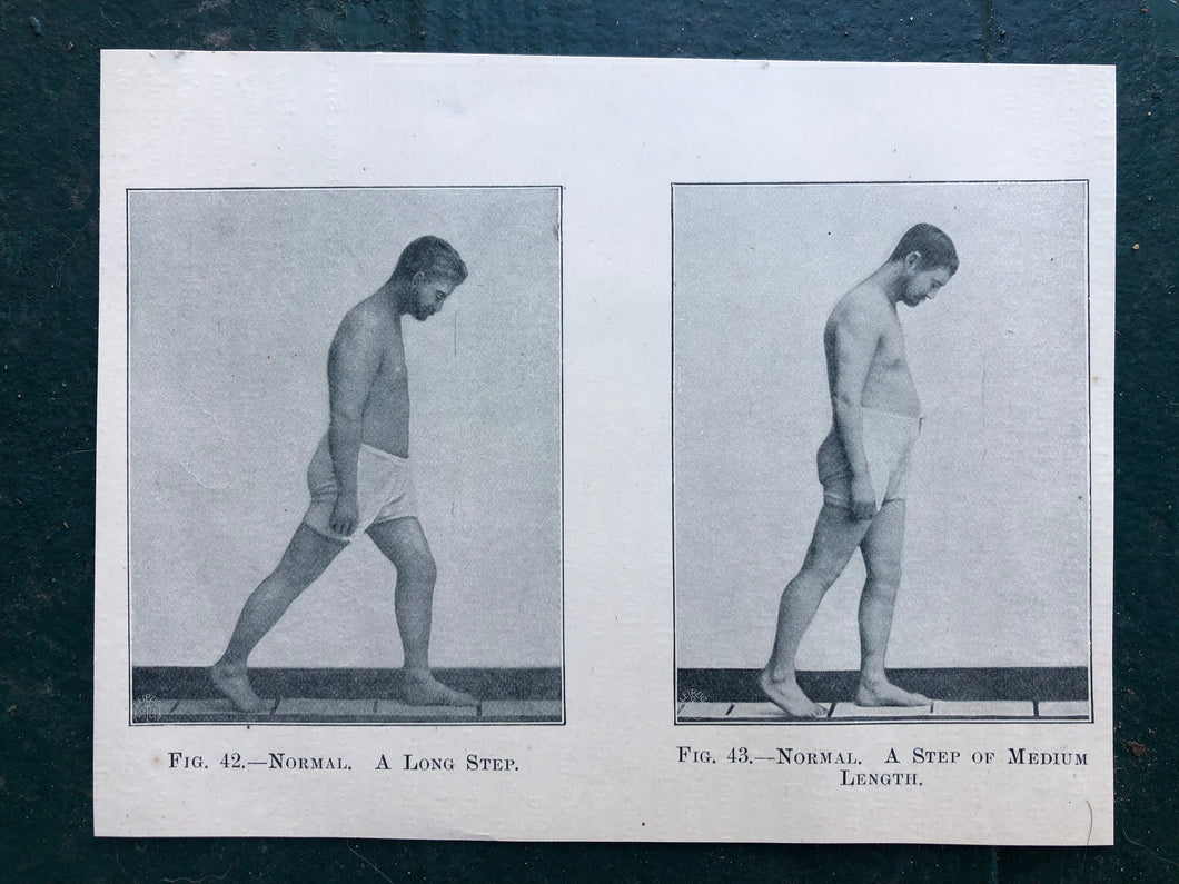 Figs. 42 and 43. Print from “The Treatment of Tabetic Ataxia by Means of Systematic Exercise” by Dr. H. S. Frenkel