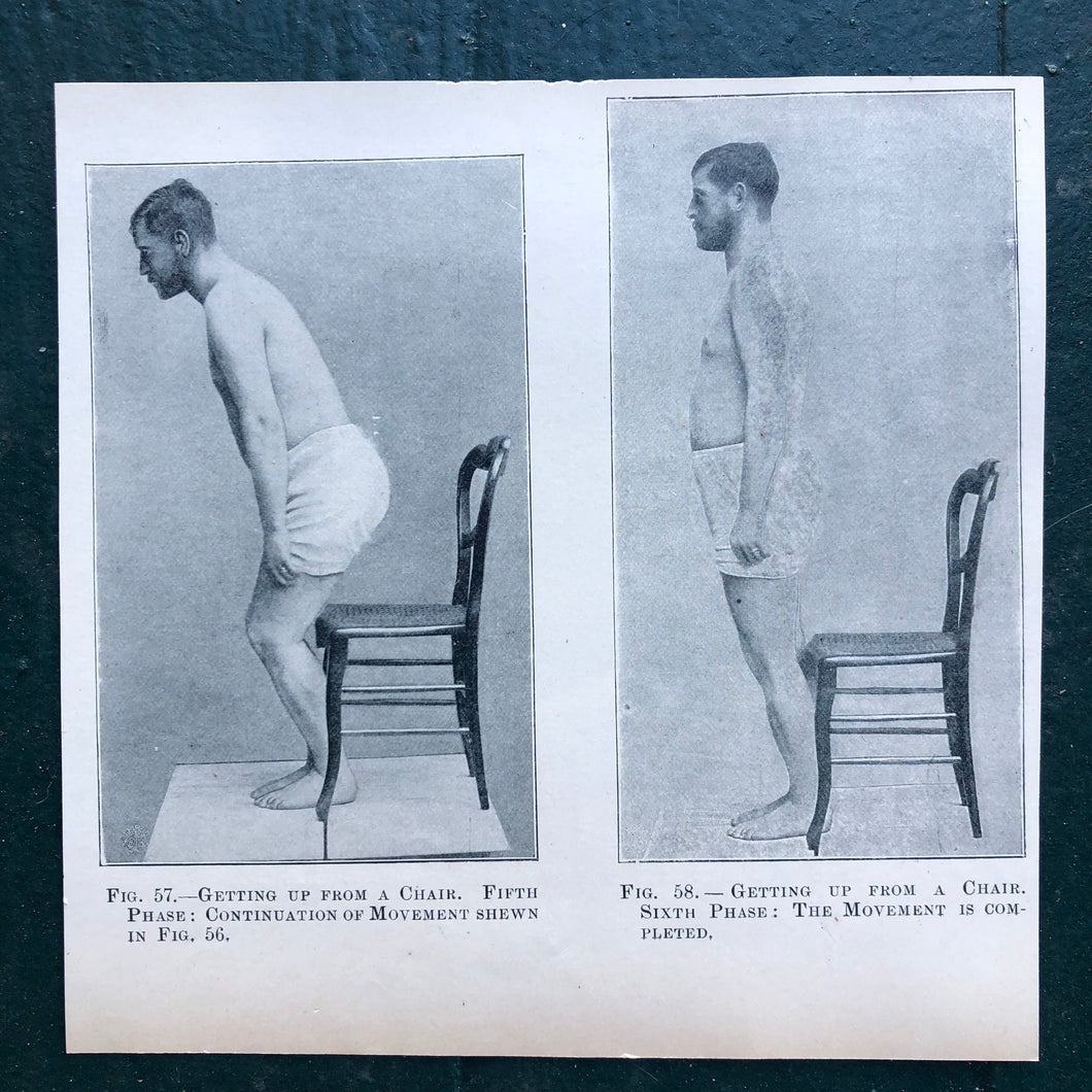 Figs. 57 and 58. Print from “The Treatment of Tabetic Ataxia by Means of Systematic Exercise” by Dr. H. S. Frenkel
