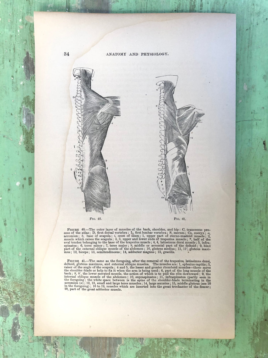 Print from “Wood’s Household Practice of Medicine, Hygeine and Surgery, Vol. I”
