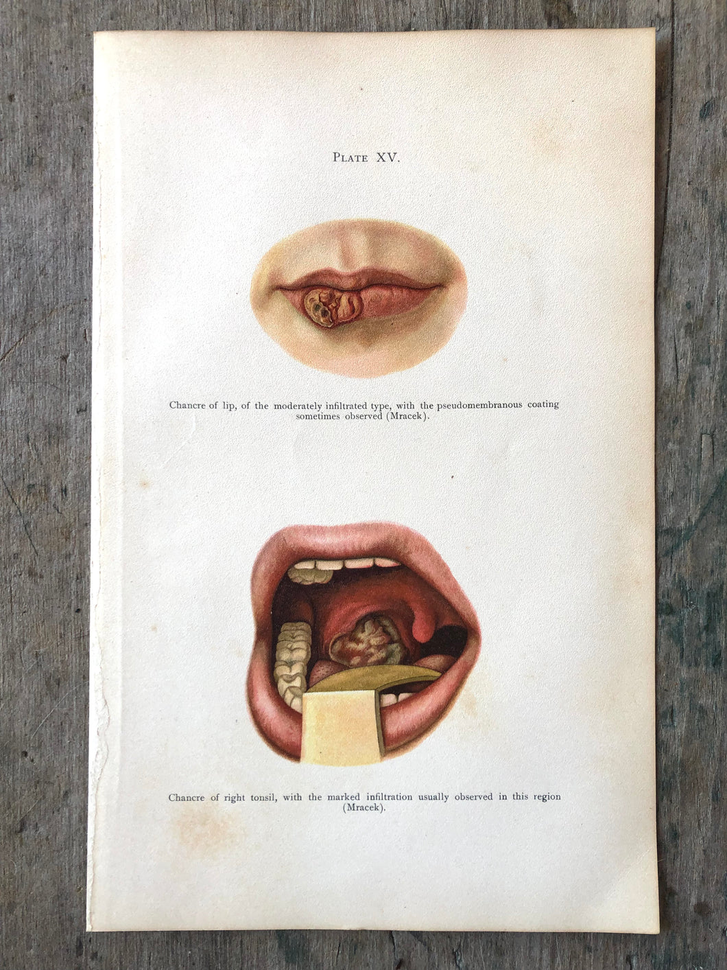 Plate XV from 