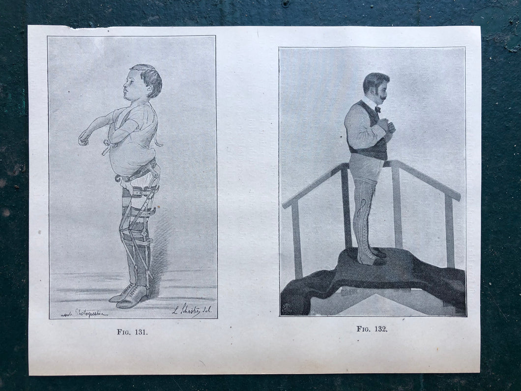 Figs. 131 and 132. Print from “The Treatment of Tabetic Ataxia by Means of Systematic Exercise” by Dr. H. S. Frenkel